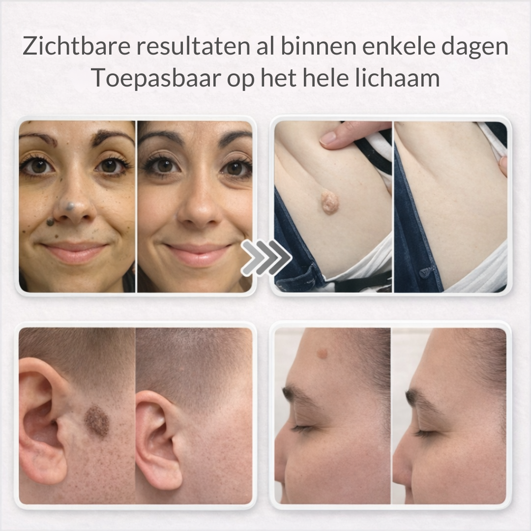 Lovera Care - Micronaald-Pleister