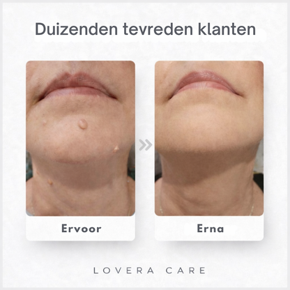 Lovera Care - Micronaald-Pleister