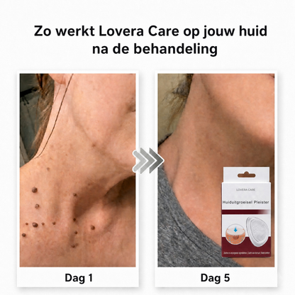 Lovera Care - Huiduitgroeisel Pleister